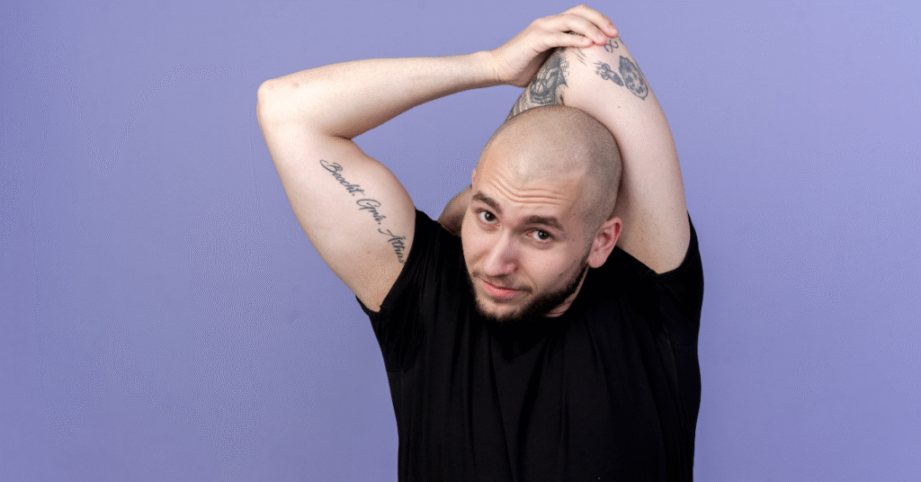  Receding Hairline